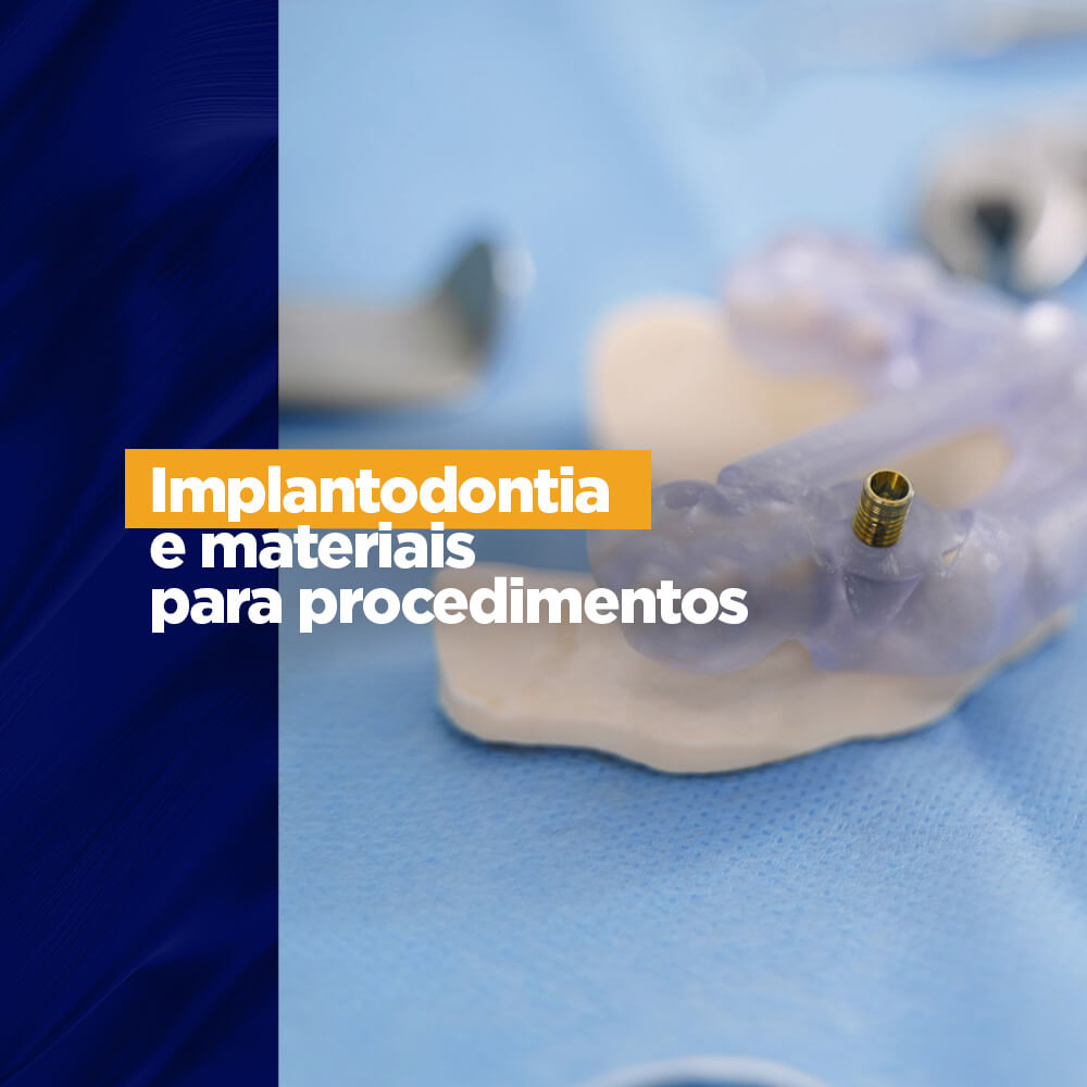 Implantodontia E Os Materiais Para Procedimentos Gnatus 8784